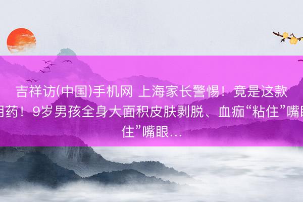 吉祥访(中国)手机网 上海家长警惕！竟是这款常用药！9岁男孩全身大面积皮肤剥脱、血痂“粘住”嘴眼…